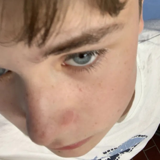 Elias.L