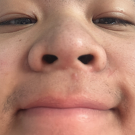 CAN